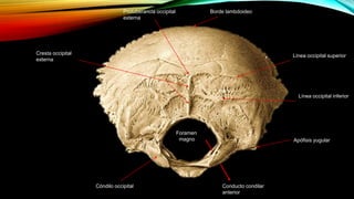 Protuberancia occipital
externa
Borde lambdoideo
Línea occipital superior
Línea occipital inferior
Cresta occipital
externa
Foramen
magno
Cóndilo occipital
Apófisis yugular
Conducto condilar
anterior
 