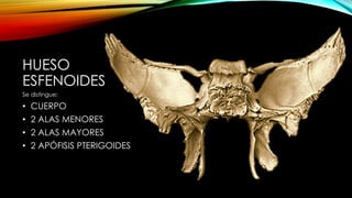 HUESO
ESFENOIDES
Se distingue:
• CUERPO
• 2 ALAS MENORES
• 2 ALAS MAYORES
• 2 APÓFISIS PTERIGOIDES
 