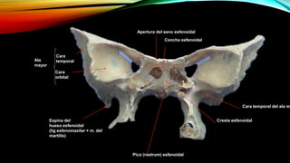 Apertura del seno esfenoidal
Concha esfenoidal
Pico (rostrum) esfenoidal
Cara
orbital
Cara
temporalAla
mayor
Espina del
hueso esfenoidal
(lig esfenomaxilar + m. del
martillo)
Cresta esfenoidal
Cara temporal del ala ma
 
