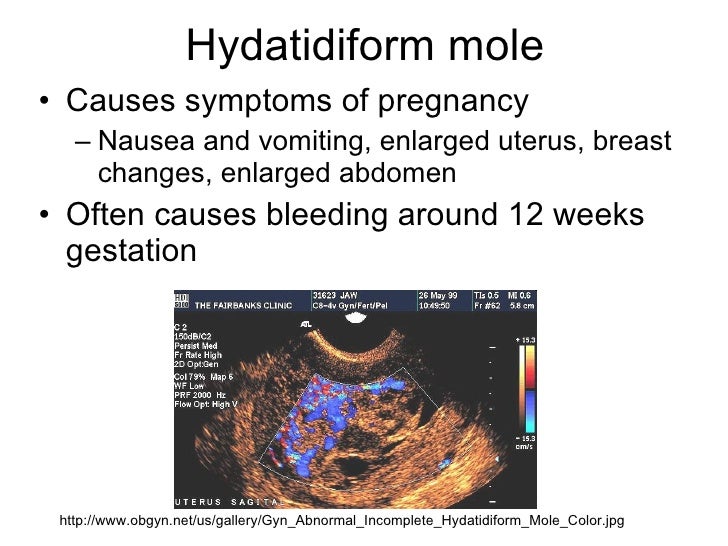 Confirming pregnancy