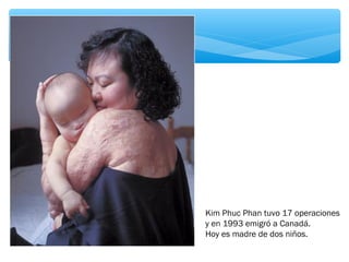 Kim Phuc Phan tuvo 17 operaciones 
y en 1993 emigró a Canadá. 
Hoy es madre de dos niños. 
 