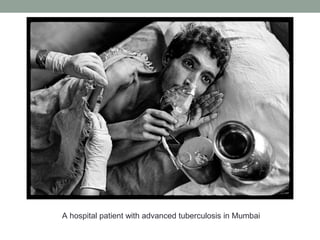 A hospital patient with advanced tuberculosis in Mumbai
 