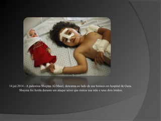 14.jul.2014 - A palestina Shayma Al-Masri, descansa ao lado de sua boneca em hospital de Gaza.
Shayma foi ferida durante um ataque aéreo que matou sua mãe e seus dois irmãos.
 