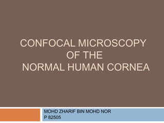 CONFOCAL MICROSCOPY
OF THE
NORMAL HUMAN CORNEA
MOHD ZHARIF BIN MOHD NOR
P 82505
 