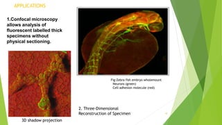 APPLICATIONS
1.Confocal microscopy
allows analysis of
fluorescent labelled thick
specimens without
physical sectioning.
10
Fig:Zebra fish embryo wholemount
Neurons (green)
Cell adhesion molecule (red)
2. Three-Dimensional
Reconstruction of Specimen
3D shadow projection
 