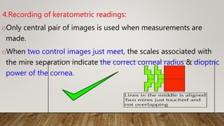 4.Recording of keratometric readings:
oOnly central pair of images is used when measurements are
made.
oWhen two control images just meet, the scales associated with
the mire separation indicate the correct corneal radius & dioptric
power of the cornea.
 