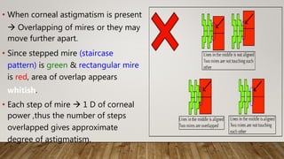 • When corneal astigmatism is present
 Overlapping of mires or they may
move further apart.
• Since stepped mire (staircase
pattern) is green & rectangular mire
is red, area of overlap appears
whitish.
• Each step of mire  1 D of corneal
power ,thus the number of steps
overlapped gives approximate
degree of astigmatism.
 