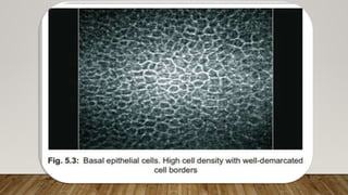 (Fig. 5.2).
(Fig. 5.3).
 