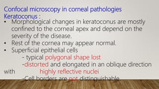 Confocal microscopy in corneal pathologies
Keratoconus :
• Morphological changes in keratoconus are mostly
confined to the corneal apex and depend on the
severity of the disease.
• Rest of the cornea may appear normal.
• Superficial epithelial cells
- typical polygonal shape lost
-distorted and elongated in an oblique direction
with highly reflective nuclei
-Cell borders are not distinguishable.
 