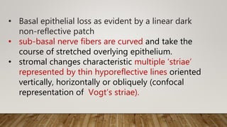 • Basal epithelial loss as evident by a linear dark
non-reflective patch
• sub-basal nerve fibers are curved and take the
course of stretched overlying epithelium.
• stromal changes characteristic multiple ‘striae’
represented by thin hyporeflective lines oriented
vertically, horizontally or obliquely (confocal
representation of Vogt’s striae).
 