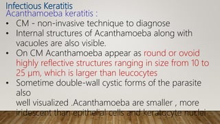 Infectious Keratitis
Acanthamoeba keratitis :
• CM - non-invasive technique to diagnose
• Internal structures of Acanthamoeba along with
vacuoles are also visible.
• On CM Acanthamoeba appear as round or ovoid
highly reflective structures ranging in size from 10 to
25 µm, which is larger than leucocytes
• Sometime double-wall cystic forms of the parasite
also
well visualized .Acanthamoeba are smaller , more
iridescent than epithelial cells and keratocyte nuclei
 