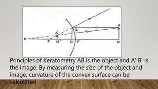 Principles of Keratometry AB is the object and A' B' is
the image. By measuring the size of the object and
image, curvature of the convex surface can be
calculated
 