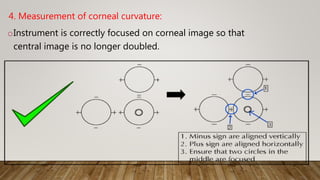 4. Measurement of corneal curvature:
oInstrument is correctly focused on corneal image so that
central image is no longer doubled.
 