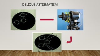 OBLIQUE ASTIGMATISM
 