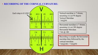 • RECORDING OF THE CORNEAL CURVATURE:
 