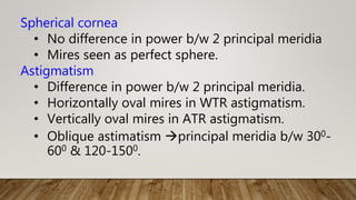 Spherical cornea
• No difference in power b/w 2 principal meridia
• Mires seen as perfect sphere.
Astigmatism
• Difference in power b/w 2 principal meridia.
• Horizontally oval mires in WTR astigmatism.
• Vertically oval mires in ATR astigmatism.
• Oblique astimatism principal meridia b/w 300-
600 & 120-1500.
 