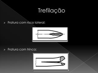    Fratura com risco lateral:




   Fratura com trinca:
 
