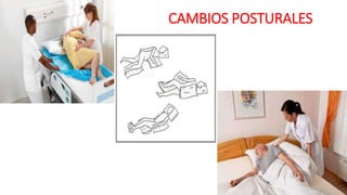 CAMBIOS POSTURALES
 