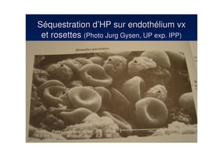 Séquestration d’HP sur endothélium vx
 et rosettes (Photo Jurg Gysen, UP exp. IPP)
 