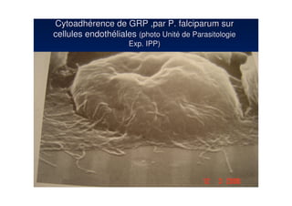 Cytoadhérence de GRP ,par P. falciparum sur
cellules endothéliales (photo Unité de Parasitologie
                     Exp. IPP)
 