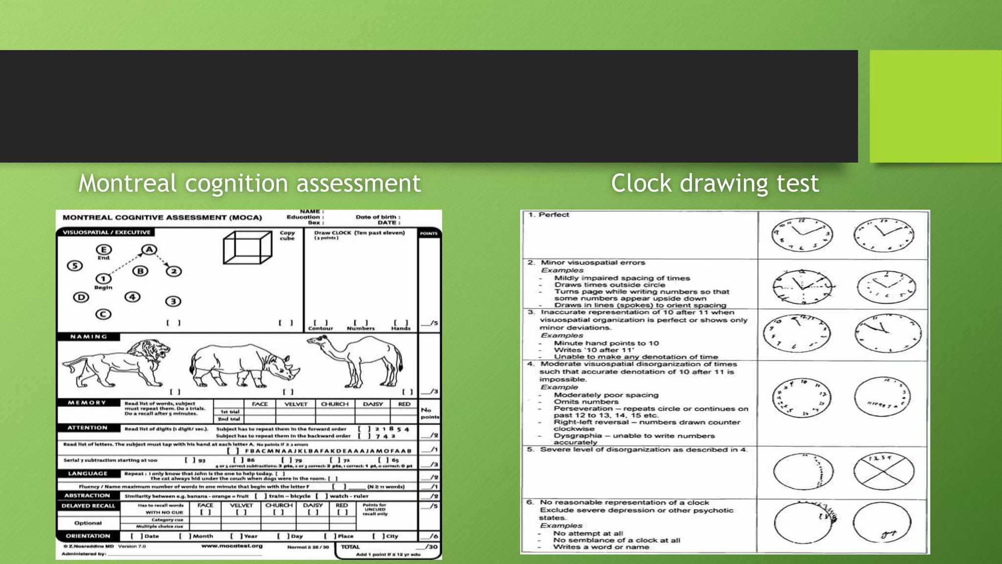 Montreal cognition assessment Clock drawing test
 