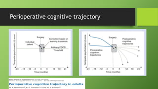 Perioperative cognitive trajectory
 