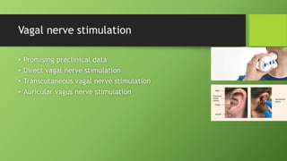 Vagal nerve stimulation
• Promising preclinical data
• Direct vagal nerve stimulation
• Transcutaneous vagal nerve stimulation
• Auricular vagus nerve stimulation
 