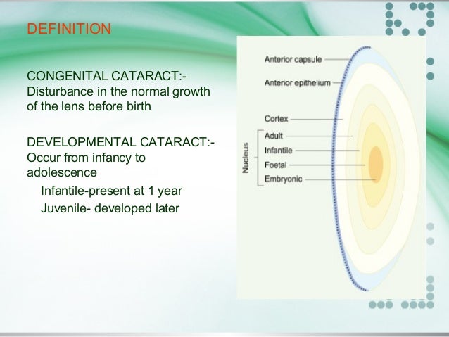 Congenital Glaucoma And Congenital Cataract