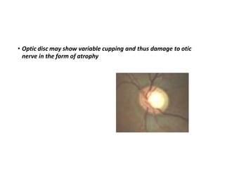 • Optic disc may show variable cupping and thus damage to otic
nerve in the form of atrophy
 