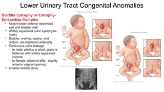 congenital-anomalies-urinary-system.pptx