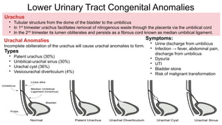 congenital-anomalies-urinary-system.pptx