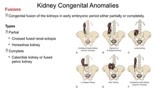 congenital-anomalies-urinary-system.pptx