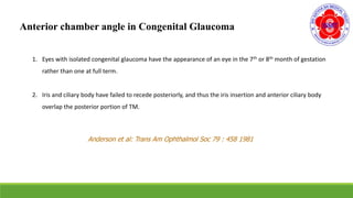 Anterior chamber angle in Congenital Glaucoma
1. Eyes with isolated congenital glaucoma have the appearance of an eye in the 7th or 8th month of gestation
rather than one at full term.
2. Iris and ciliary body have failed to recede posteriorly, and thus the iris insertion and anterior ciliary body
overlap the posterior portion of TM.
Anderson et al: Trans Am Ophthalmol Soc 79 : 458 1981
 
