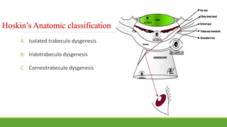 Hoskin’s Anatomic classification
A. Isolated trabeculo dysgenesis
B. Iridotrabeculo dysgenesis
C. Corneotrabeculo dysgenesis
 