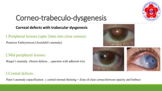 Corneo-trabeculo-dysgenesis
Corneal defects with trabecular dysgenesis
1.Peripheral lesions (upto 2mm into clear cornea):
Posterior Embryotoxon (Axenfeld’s anomaly)
2.Mid peripheral lesions:
Rieger’s anomaly (Sector defects….opacities with adherent iris)
3.Central defects:
Peter’s anomaly (opacification + central stromal thinning + Zone of clear cornea between opacity and limbus)
 