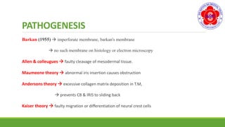 PATHOGENESIS
Barkan (1955)  imperforate membrane, barkan's membrane
 no such membrane on histology or electron microscopy
Allen & colleugues  faulty cleavage of mesodermal tissue.
Maumeene theory  abnormal iris insertion causes obstruction
Andersons theory  excessive collagen matrix deposition in T.M,
 prevents CB & IRIS to sliding back
Kaiser theory  faulty migration or differentiation of neural crest cells
 