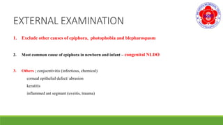 EXTERNAL EXAMINATION
1. Exclude other causes of epiphora, photophobia and blepharospasm
2. Most common cause of epiphora in newborn and infant – congenital NLDO
3. Others ; conjucntivitis (infectious, chemical)
corneal epithelial defect/ abrasion
keratitis
inflammed ant segmant (uveitis, trauma)
 