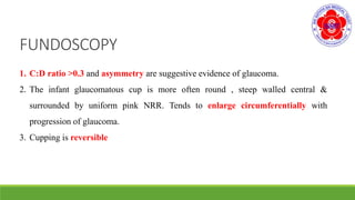 FUNDOSCOPY
1. C:D ratio >0.3 and asymmetry are suggestive evidence of glaucoma.
2. The infant glaucomatous cup is more often round , steep walled central &
surrounded by uniform pink NRR. Tends to enlarge circumferentially with
progression of glaucoma.
3. Cupping is reversible
 