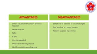 ADVANTAGES
1. Direct visualisations allows prescice
location
2. Less traumatic
3. Safe
4. Rapid
5. Can be repeated
6. Doesn’t injure conjunctiva
7. No bleb related complications
DISADVANTAGES
1. Lens have to be used to visualise angle
2. Not possible in cloudy corneas
3. Require surgical experience
 