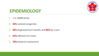 EPIDEMIOLOGY
1. 1 in 10000 births
2. 50% isolated congenital
3. 60% diagnosed by 6 months and 80% by 1 year
4. 65% affected are males
5. 70% bilateral involvement
 