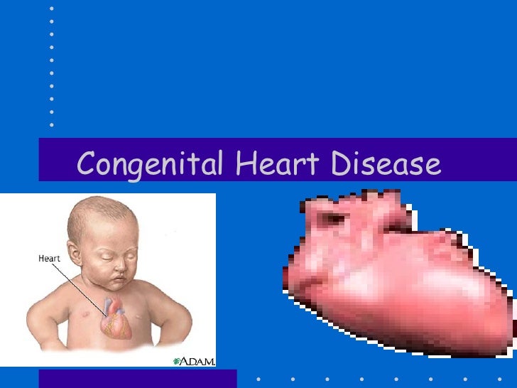 Congenital