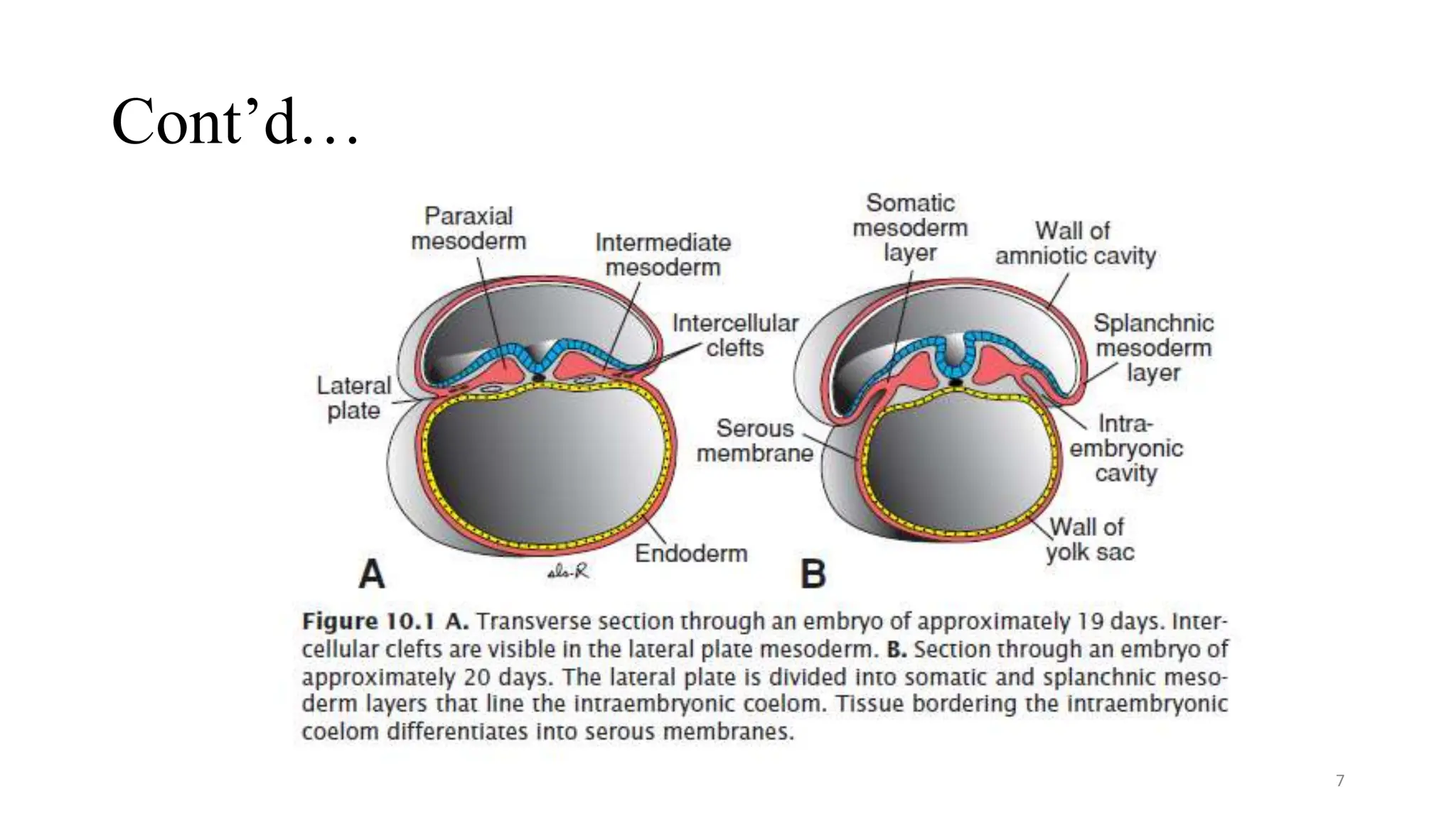 Approach to Congenital abdominal wall defects .pptx