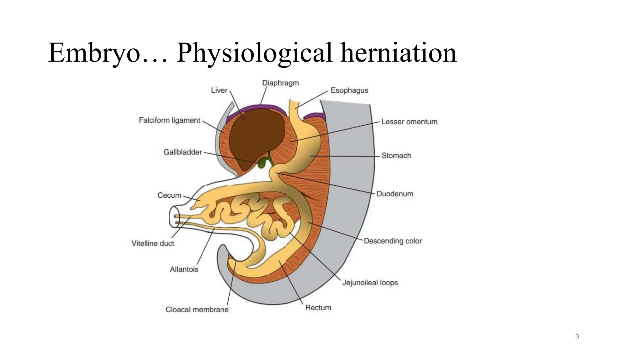 Approach to Congenital abdominal wall defects .pptx