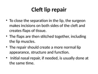 Cleft lip repair
• To close the separation in the lip, the surgeon
makes incisions on both sides of the cleft and
creates flaps of tissue.
• The flaps are then stitched together, including
the lip muscles.
• The repair should create a more normal lip
appearance, structure and function.
• Initial nasal repair, if needed, is usually done at
the same time.
 