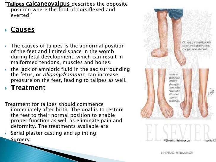 Congenital abnormalities by Erum Khowaja