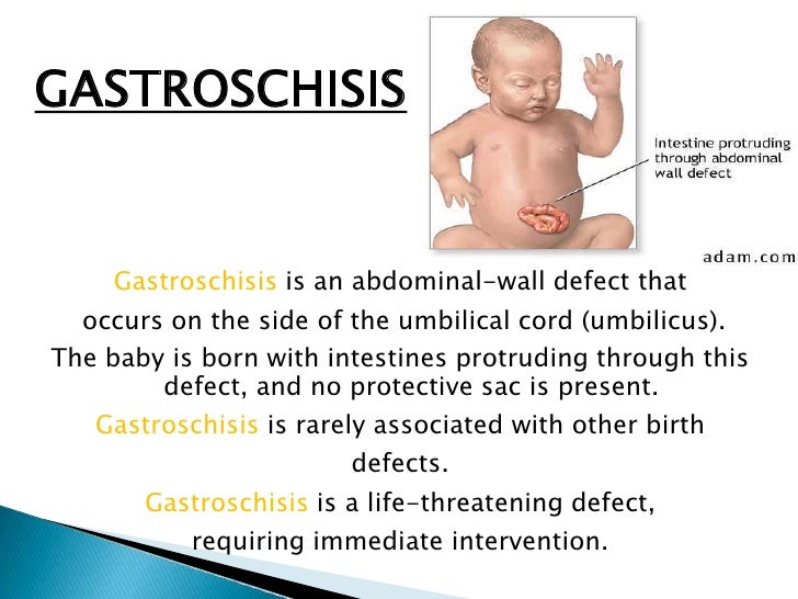 Congenital abnormalities by Erum Khowaja