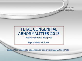 FETAL CONGENITAL
ABNORMALITIES 2013
Mendi General Hospital
Papua New Guinea
FETAL CONGENITAL
ABNORMALITIES 2013
Mendi General Hospital
Papua New Guinea
Some of the Congenital abnormalities delivered @ our Birthing Units
QuickTime™ and a
decompressor
are needed to see this picture.
 