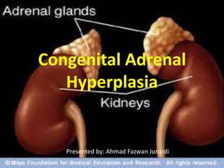 Congenital Adrenal Hyperplasia Presented by: Ahmad FazwanJunaidi 