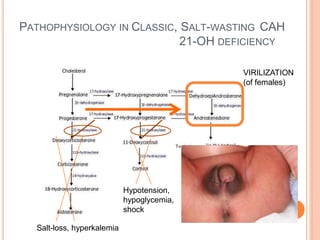 PATHOPHYSIOLOGY IN CLASSIC, SALT-WASTING CAH
21-OH DEFICIENCY
VIRILIZATION
(of females)
Hypotension,
hypoglycemia,
shock
Salt-loss, hyperkalemia
 