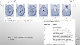 Brook’s Clinical Pediatric Endocrinology-
7th
Edition
 